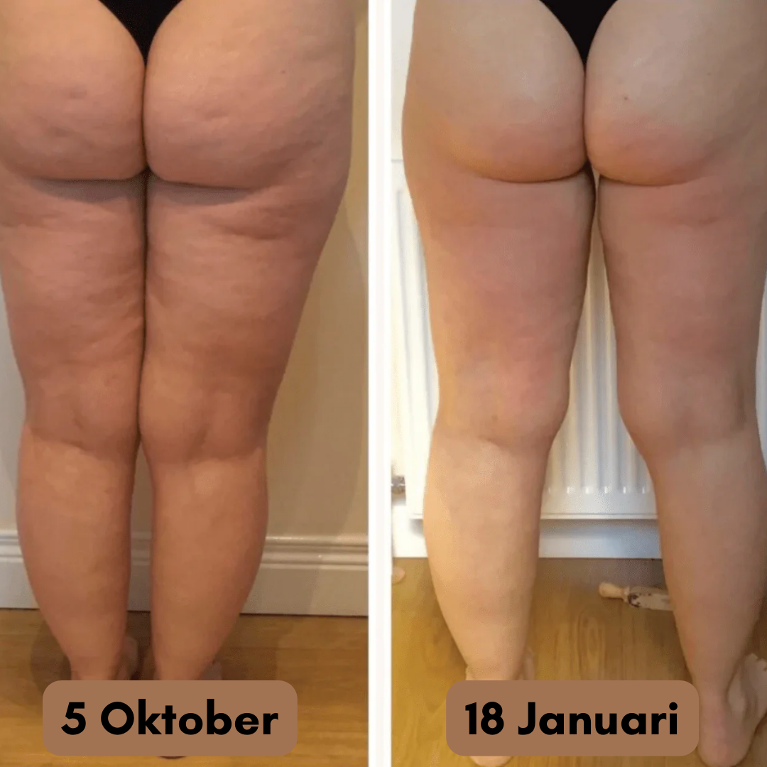 Anti Cellulite Leggings - Den permanenta lösningen på dina celluliter